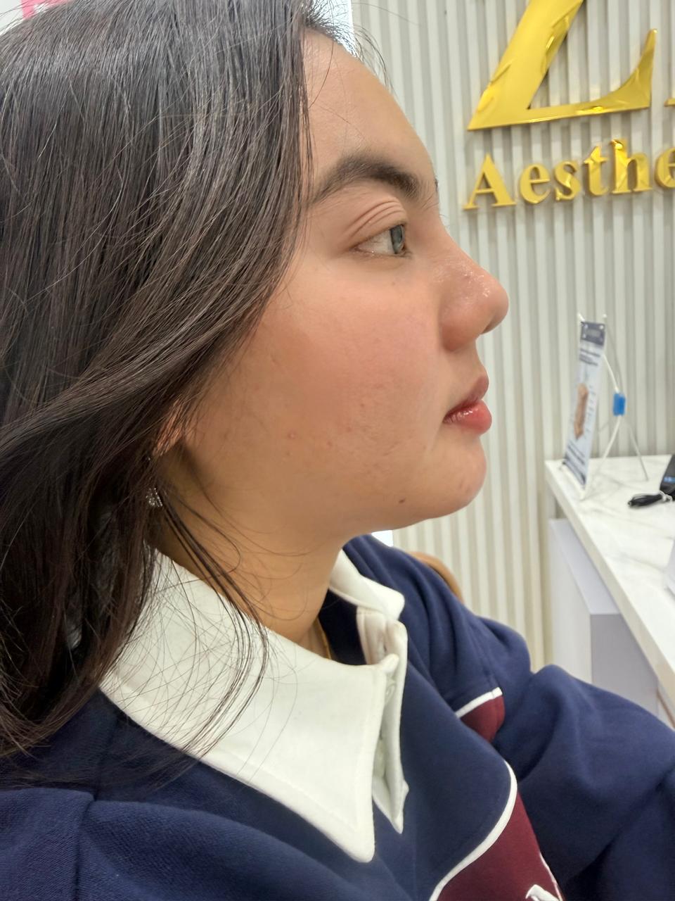 Sesudah - Cellbooster Shape