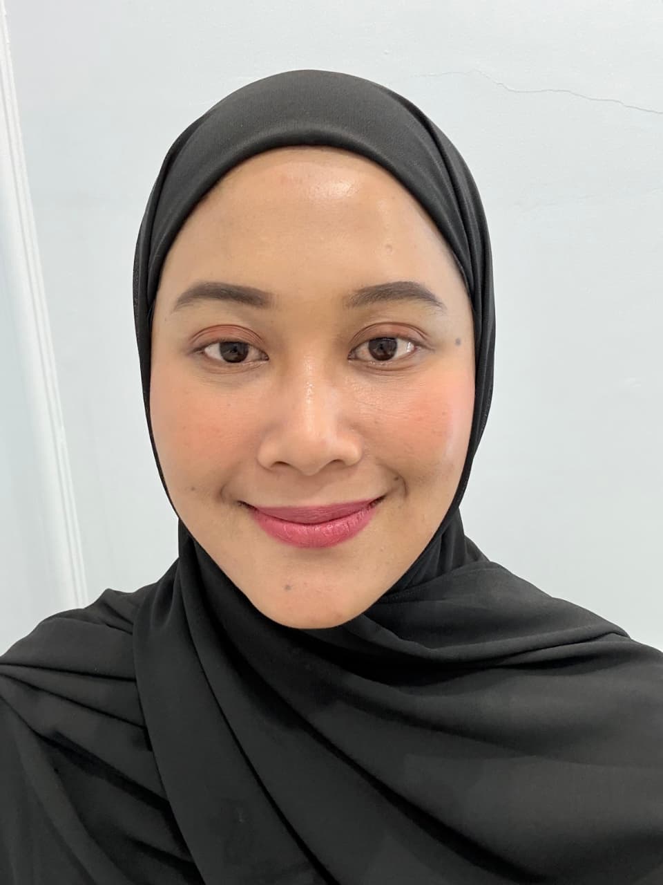 Sesudah - Laser Co2 + Skinbooster Rejuran + Skinbooster NCTF